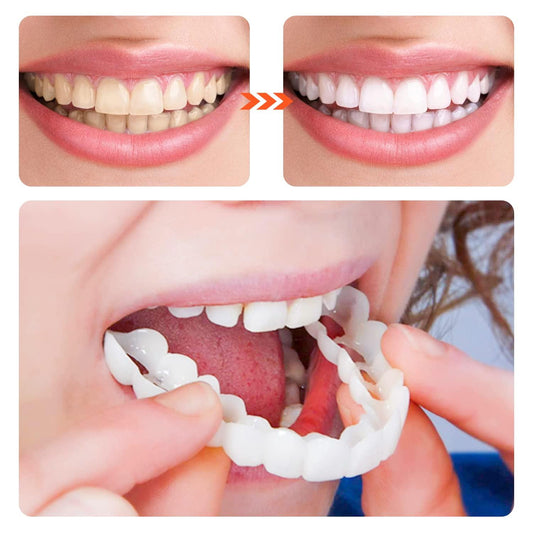 Teeth Veneer™