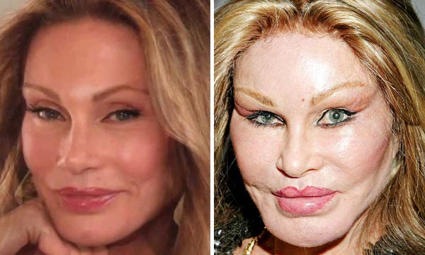 Top 10 Most Expensive Plastic Surgeries Ever