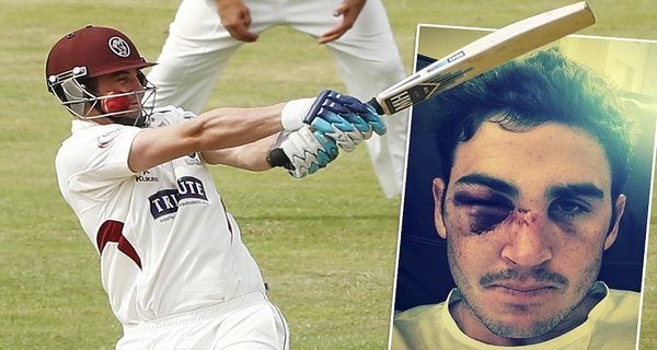 Worst cricket injuries Kieswetter